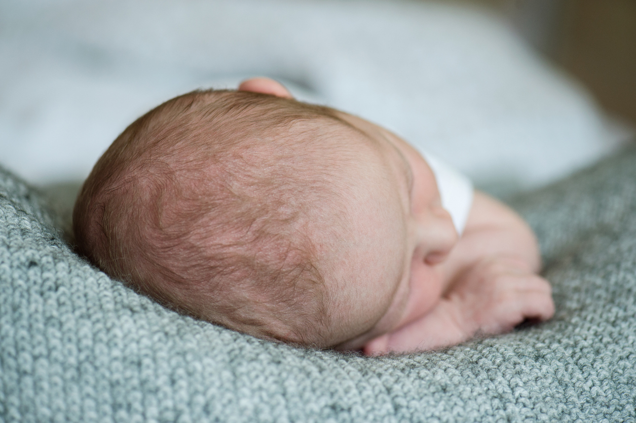 Causes & Symptoms of Caput Succedaneum